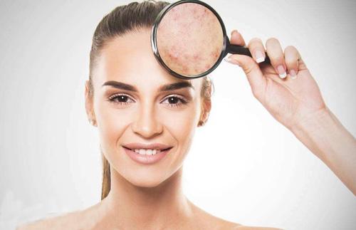 一水甜菜堿：調(diào)節(jié)表皮代謝，改善干燥粗糙，重塑緊致肌膚的秘密武器